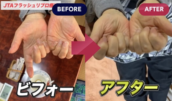 JTAフラッシュリプロ療法のビフォーアフター1