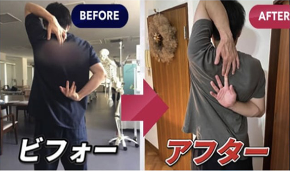 JTAフラッシュリプロ療法のビフォーアフター3