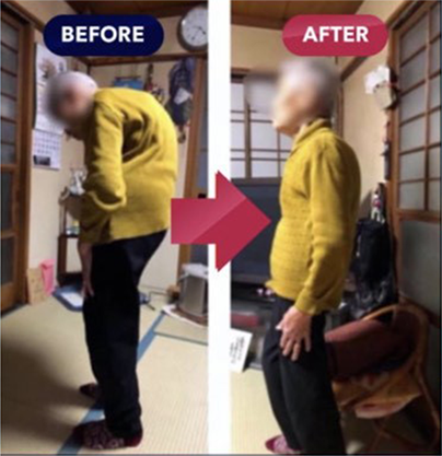 JTAフラッシュリプロ療法のビフォーアフター4